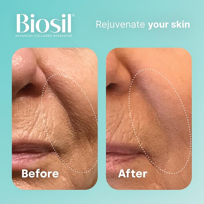 Biosil Collagen Generator - 120 Original Capsules, Pack of 2 - with Patented ch-OSA Complex - Generates & Protects Your Own Collagen - GMO Free - 120-Day Supply